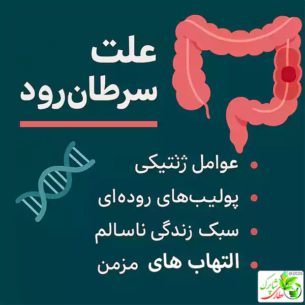 علت سرطان روده مجموعه‌ای از عوامل ژنتیکی، محیطی و سبک زندگی است